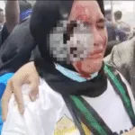 Aisun Salim HMI Maluku Utara mengalami tindakan represif polisi saat demo mahasiswa di DPRD Halmahera Selatan, Selasa 2 September 2025.