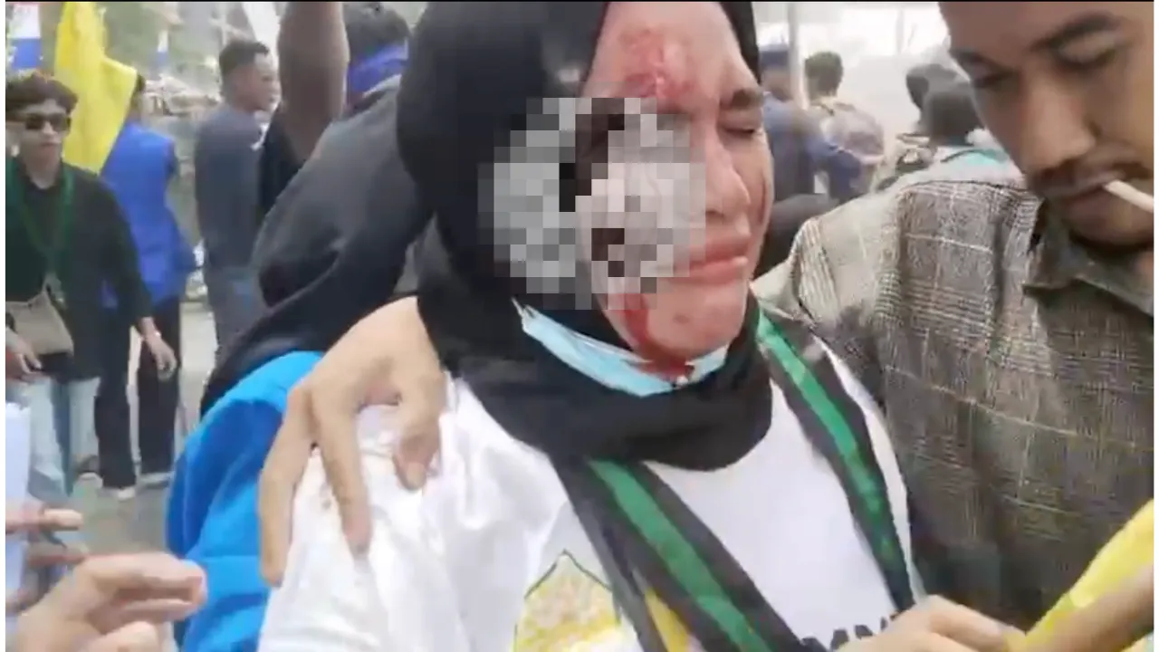 Aisun Salim HMI Maluku Utara mengalami tindakan represif polisi saat demo mahasiswa di DPRD Halmahera Selatan, Selasa 2 September 2025.