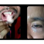 Kondisi wajah salah satu warga adat Maba Sangaji yang tampak mengalami lebam, menurut keterangan keluarga akibat insiden di Rutan Soasio. Hingga berita ini dirilis, pihak rutan belum memberikan keterangan resmi.