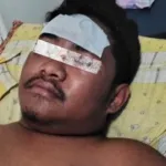 korban penganiayaan di Desa Soakonora, Kecamatan Galela Selatan, Halmahera Utara,Sumber foto: Istimewa